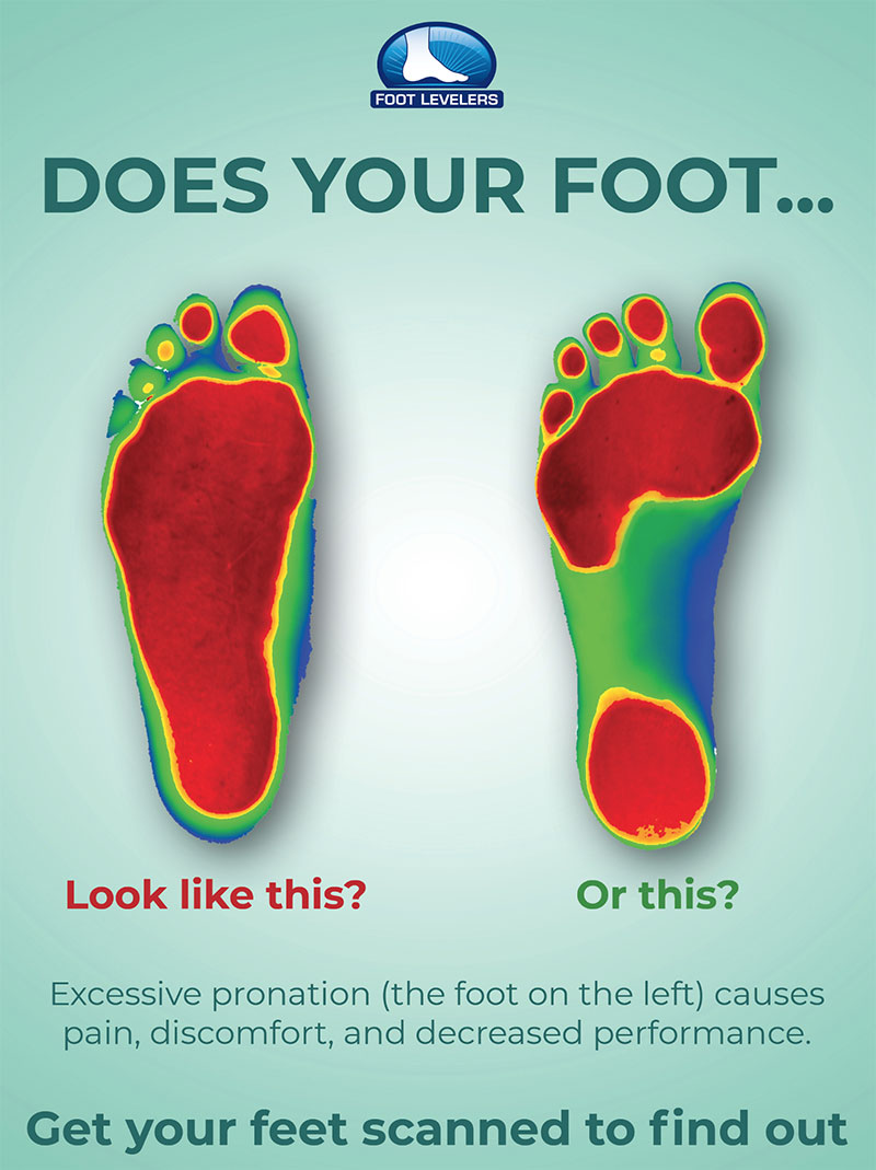 [Video] Orthotics Foot Levelers Champions Chiropractic Center